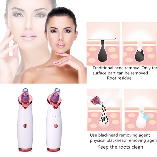 Blackhead Remover Instrument Black Dot Remover Acne Vacuum Suction Face Clean Black Head Pore Cleaning Beauty Skin Care Tool - Image 3